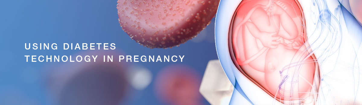 Using Diabetes Technology in Pregnancy Image